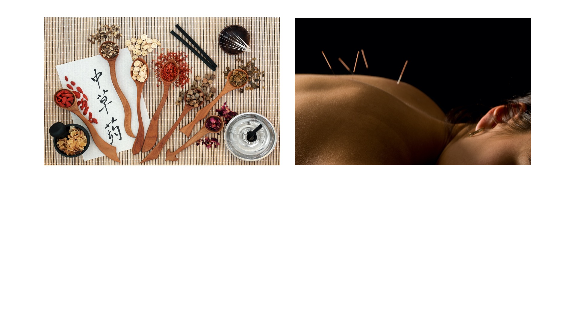 vStore Banner Image Access Acupuncture
